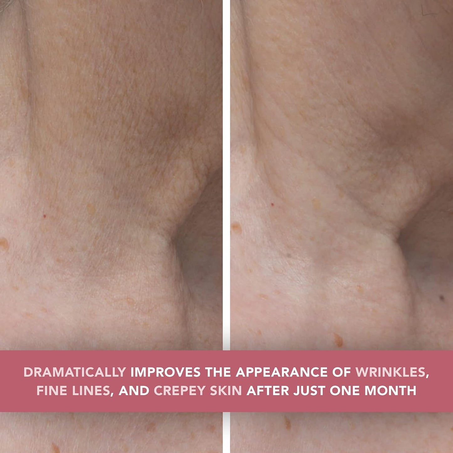 Doll 10 Smooth Assist Toning Neck & Decollete Treatment - Anti-Aging Neck Firming & Tightening Moisturizer Cream