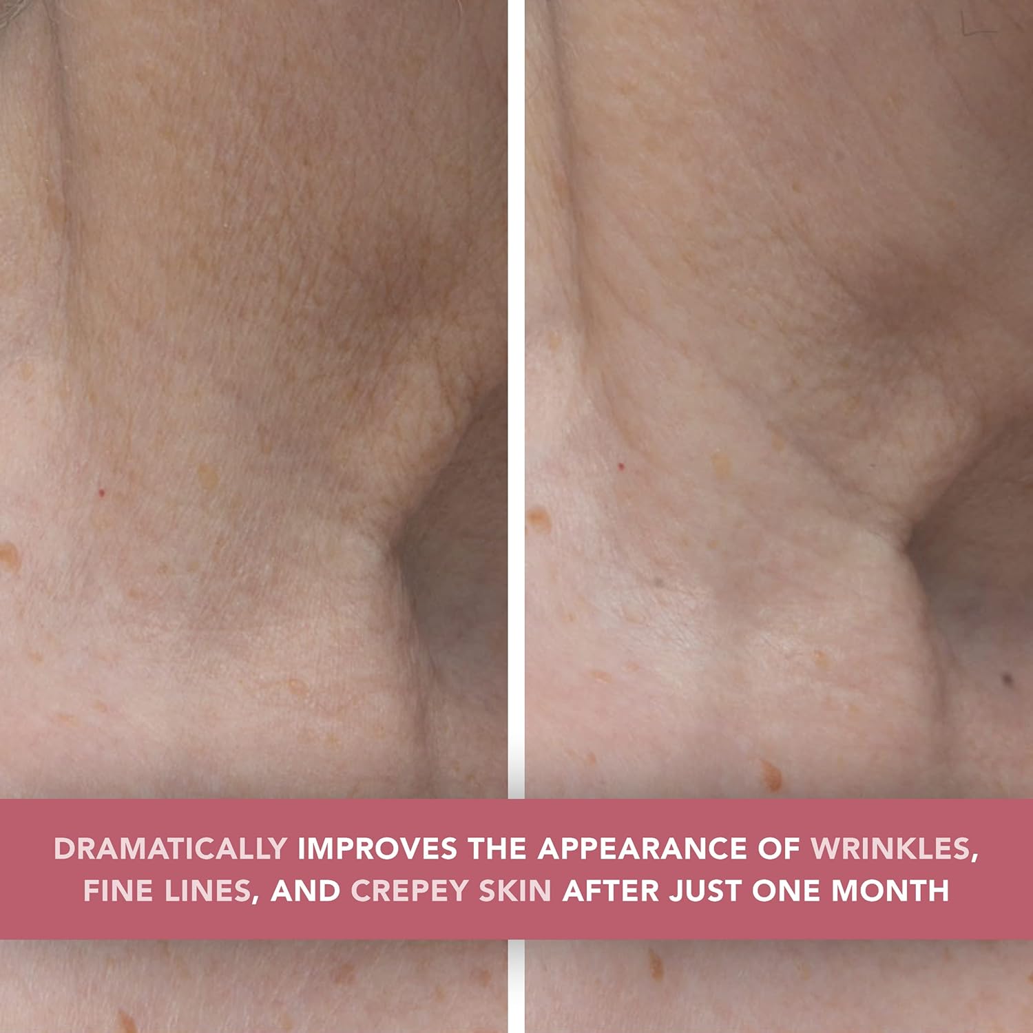 Doll 10 Smooth Assist Toning Neck & Decollete Treatment - Anti-Aging Neck Firming & Tightening Moisturizer Cream